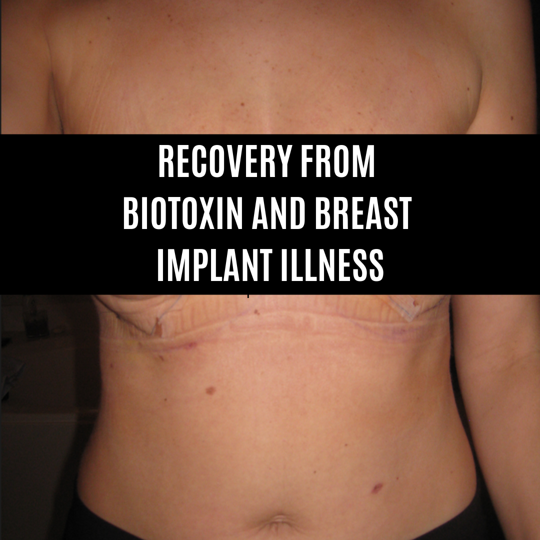 Healing from Biotoxin and Breast Implant Illness